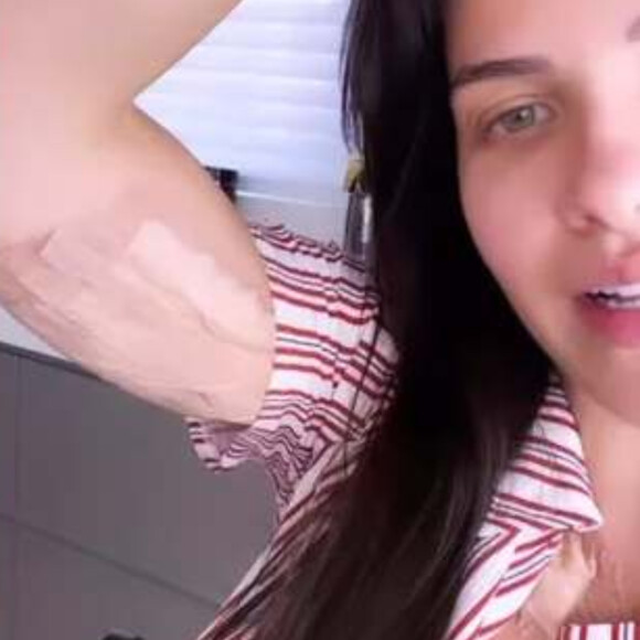 Andressa Suita mostrou o braço coberto com faixa após a remoção do desenho