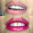 BB Lips: procedimento proporciona efeito lip tint, deixando os lábios com uma leve coloração