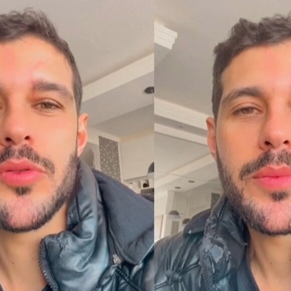 Rodrigo Mussi enfrenta doença após saída com ex-BBBs