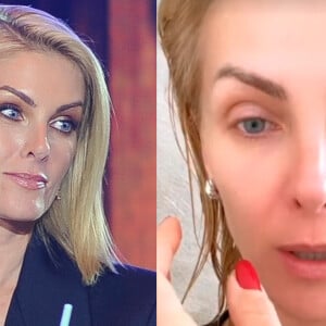 Ana Hickmann sofreu acidente com box do banheiro