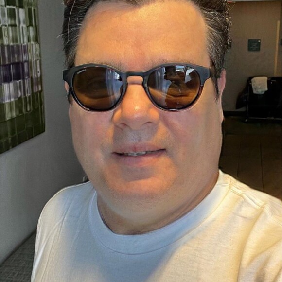 Celso Portiolli postou uma foto com o rosto mais inchado