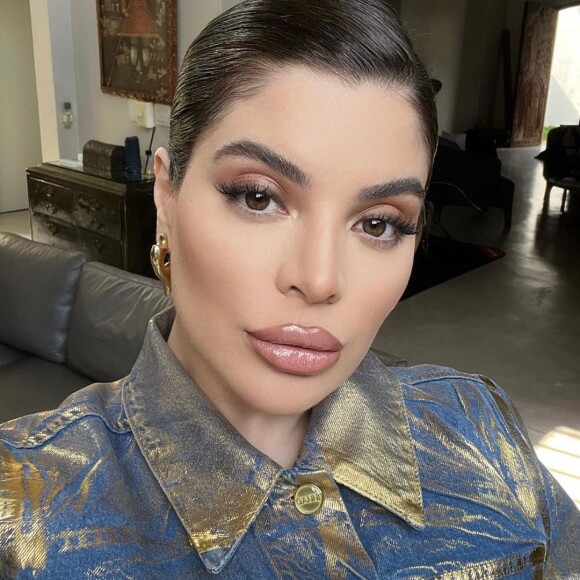 Fotos de Gkay chamavam atenção por boca volumosa