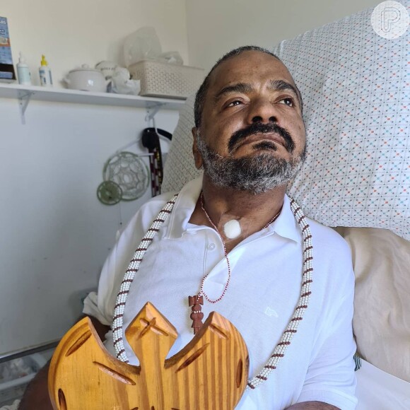 Arlindo Cruz tem vivido em um estado delicado após sofrer um AVC (Acidente Vascular Cerebral)