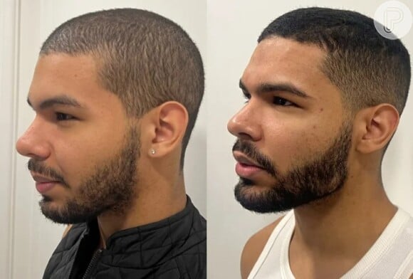 Vyni, do 'BBB 22', foi comparado com o rapper Drake após harmonização facial