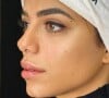 Ex-BBB 23 Key Alves mostra fotos da harmonização facial que fez no rosto: está a cara da Anitta