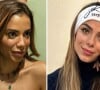 Ex-BBB 23 Key Alves mostra fotos da harmonização facial que fez no rosto: está a cara da Anitta