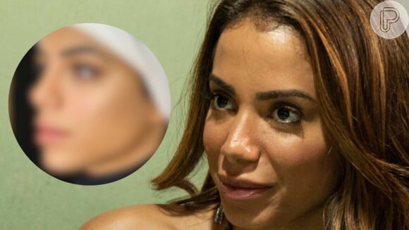 Semelhança entre ex-BBB Key Alves e Anitta impressiona após harmonização facial.  Veja fotos de antes e depois do elenco do 'BBB 23' após procedimentos estéticos
