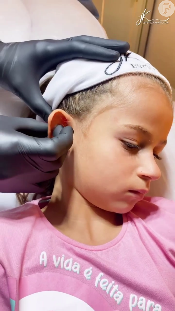 Valentina Bezerra, filha de Deolane, passou por uma otomodelação para corrigir o formato das orelhas
