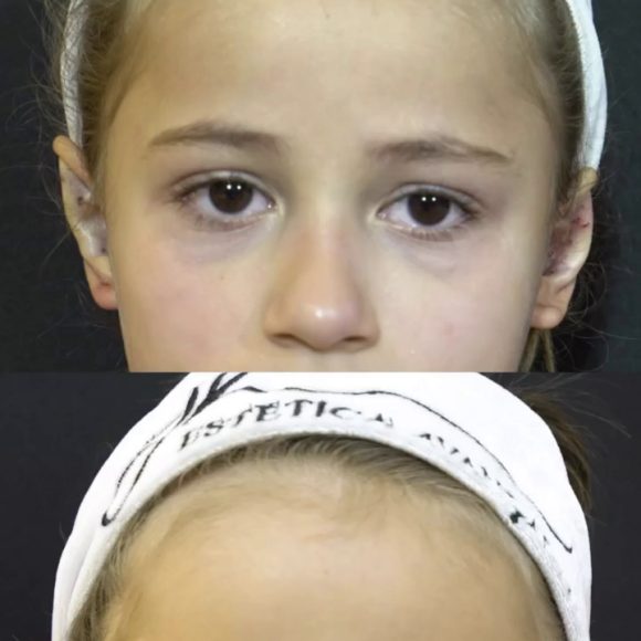 Filha de Deolane Bezerra passa por otomodelação: veja antes e depois