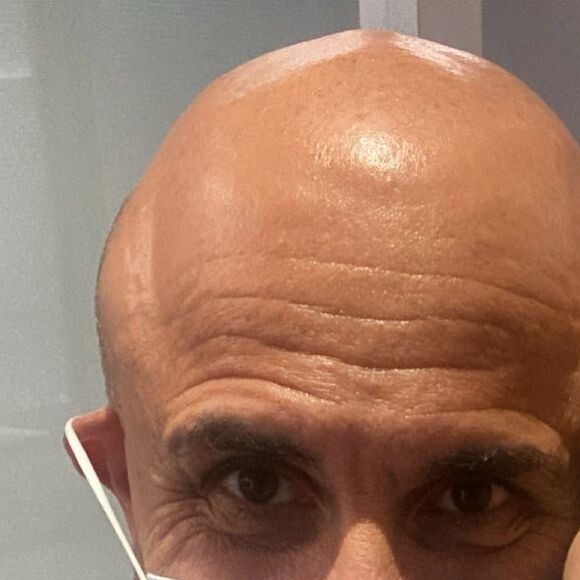 'Simony teve uma grande resposta do tratamento com quimio e radioterapia, em uma lesão intestinal', iniciou o médico oncologista Fernando Maluf
