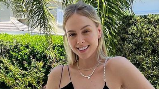 Afinal, o que é mama acessória? Tata Estaniecki explica condição após mostrar terceiro mamilo na axila: 'Sai leite'. Veja!