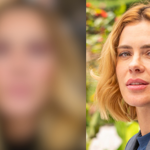 Carolina Dieckmann fez harmonização facial? Atriz de 'Vai Na Fé' é acusada de preenchimentos no rosto após inchaço