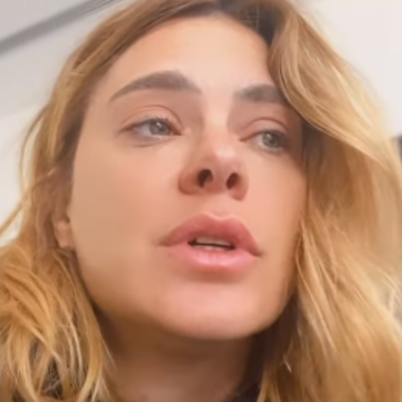 Carolina Dieckmann afirma estar com o rosto inchado por conta da reação a um remédio para curar gripe