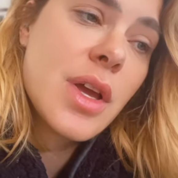 Carolina Dieckmann: 'Eu não fui na dermatologista botar boca, olho, maçã do rosto. Nada disso. Só precisei tomar um remedinho que me deixou inchada'