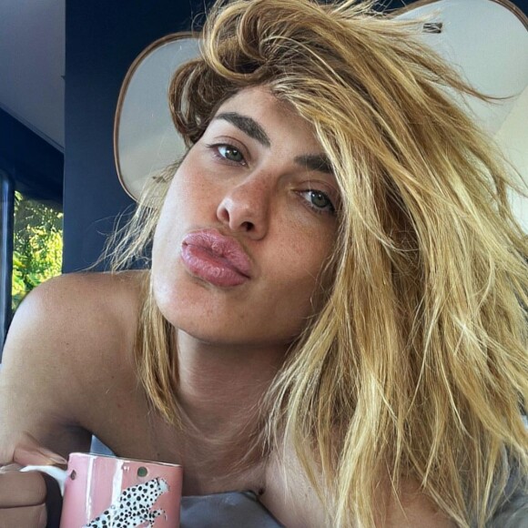 Carolina Dieckmann: há dois meses, a atriz viralizou por manter a beleza jovial sem procedimentos estéticos invasivos