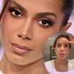 Proibido no Brasil: segredo de Anitta no skincare é feito do sangue da cantora; dermatologista opina