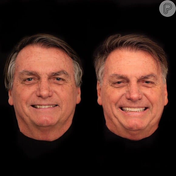 Jair Bolsonaro: veja o antes e depois de harmonização facial 