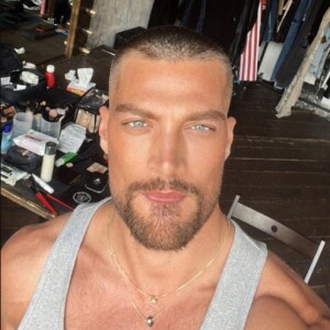 Simone Susinna aproveitou vinda ao Brasil para realizar procedimento estético