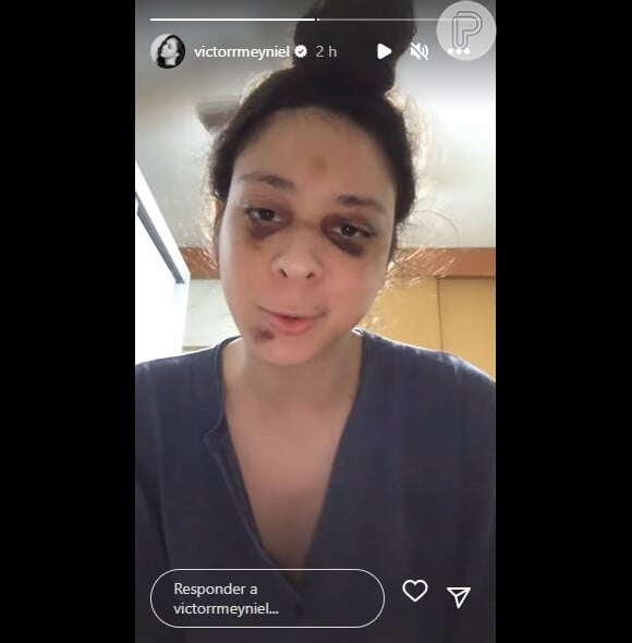 Victor Meyniel conta que seu agressor, Yuri de Moura Alexandre, teria se irritado após amiga que mora com ele voltar do trabalho