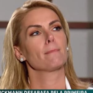 Ana Hickmann recordou lado agressor do pai e que ganhou cicatriz na mão para defender a mãe de surra: 'Abriu a cabeça dela inteira'