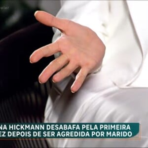 Ana Hickmann exibiu cicatriz na mão direita. Marca ficou no corpo ao cair em cima de copos e pratos para proteger a mãe do pai