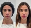 Larissa Tomásia, do 'BBB 22', transformou sua aparência através da harmonização facial