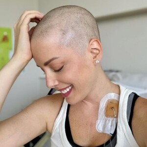Fabiana Justus raspou a cabeça quando seus cabelos começaram a cair por causa da quimioterapia