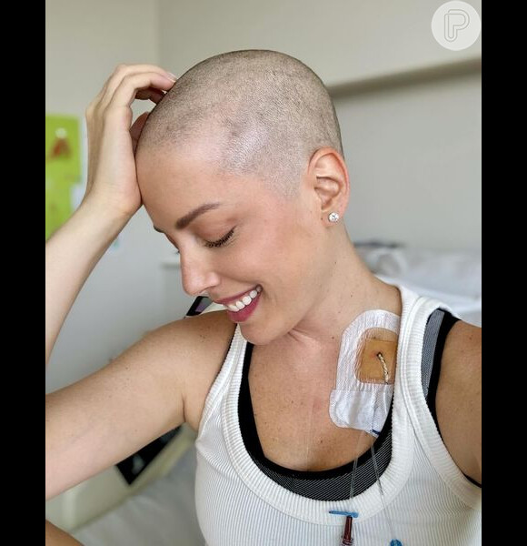 Fabiana Justus raspou a cabeça quando seus cabelos começaram a cair por causa da quimioterapia