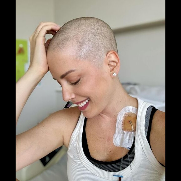 Fabiana Justus raspou a cabeça quando seus cabelos começaram a cair por causa da quimioterapia