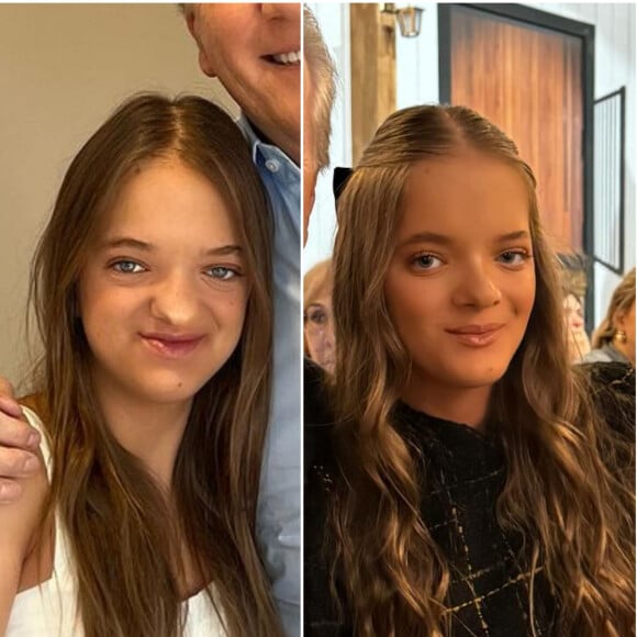 O antes e depois de Rafaella Justus impressionou a web