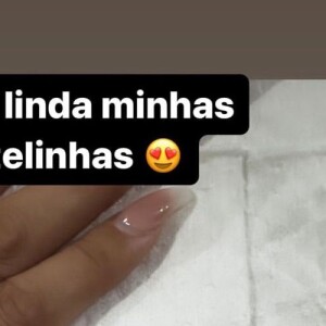 Andressa Urach retirou as costelas, fez lipoaspiração e colocou silicone nos seios há 2 semanas
