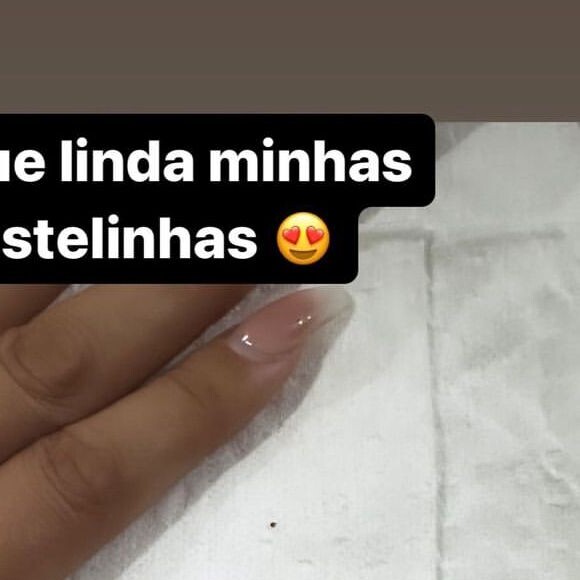 Andressa Urach retirou as costelas, fez lipoaspiração e colocou silicone nos seios há 2 semanas