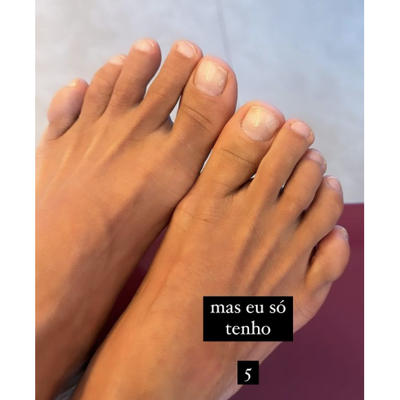 Carolina Dieckmann ainda publicou uma foto dos pés nos stories para provar que, de fato, tem 5 dedos
