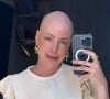 Fabiana Justus detalha cuidados com a pele em luta contra o câncer