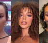Veja o antes e depois de 5 famosas que, além de Brunna Gonçalves, fizeram a frontoplastia