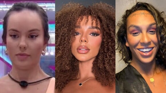 O que é frontoplastia? Veja 5 famosas que já fizeram a cirurgia plástica para diminuir tamanho da testa e fotos do antes e depois!