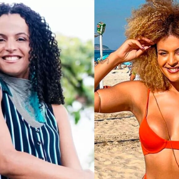 Estrela de 'Malhação' e outras novelas da Globo, Gabriela Loran diminuiu um bom tamanho da sua testa e o resultado ficou excelente