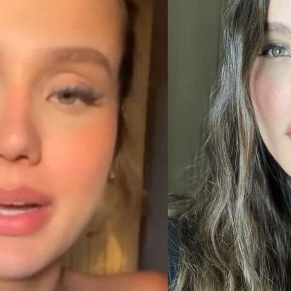 Quem também diminuiu a testa em 2 centímetros foi a influeciadora Biah Rodrigues