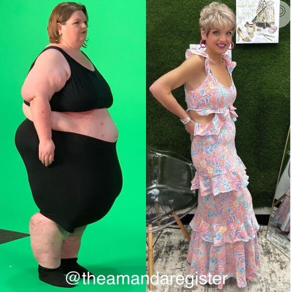 Ex-estrela de reality show, Amanda Register vem mostrando a sua transformação ao perder pouco mais de 280kg em cinco anos