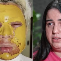 Influenciadora que fez peeling de fenol com mulher envolvida em morte chora e diz ter sido enganada: 'Disse que era biomédica'