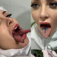 Meu Deus! Andressa Urach tem língua bifurcada e choca ao mostrar órgão cortado ao meio: 'Tá doendo, inchado e salivando bastante'