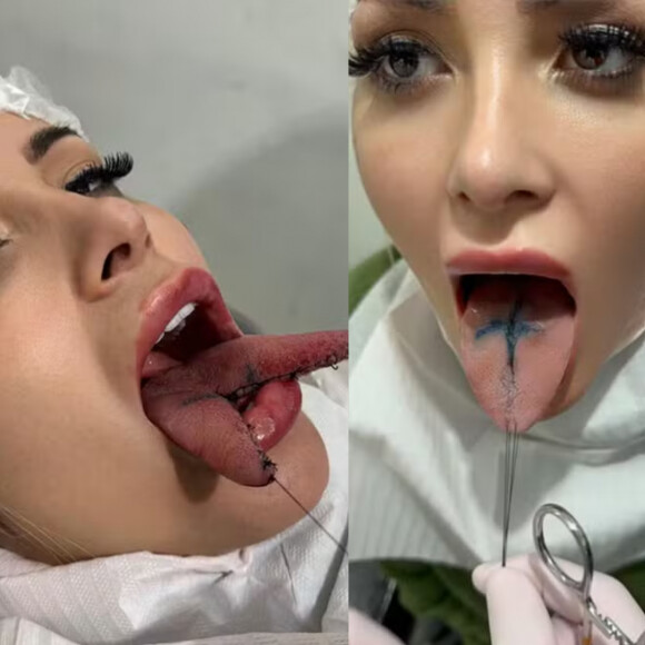 Andressa Urach tem língua bifurcada e choca ao mostrar órgão cortado ao meio: 'Tá doendo, inchado e salivando bastante'