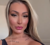 Andressa Urach tem causado polêmica com suas atitudes recentes, especialmente pelos procedimentos estéticos e plásticas realizados