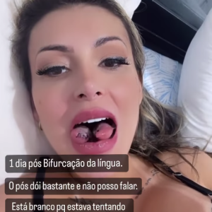 Andressa Urach confessou ter feito o procedimento para aumentar o prazer e dar 'algo diferente' para seus assinantes