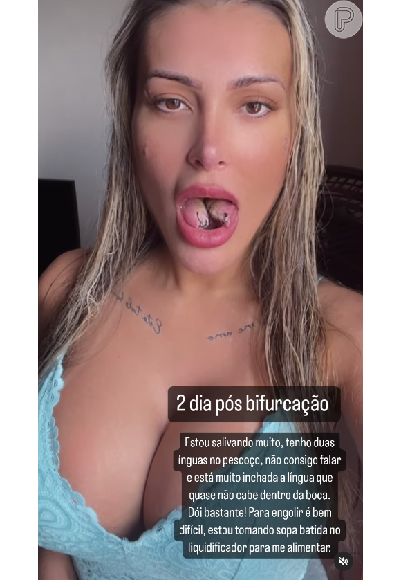 Andressa Urach confessou não estar conseguindo falar e nem comer, além das dores locais