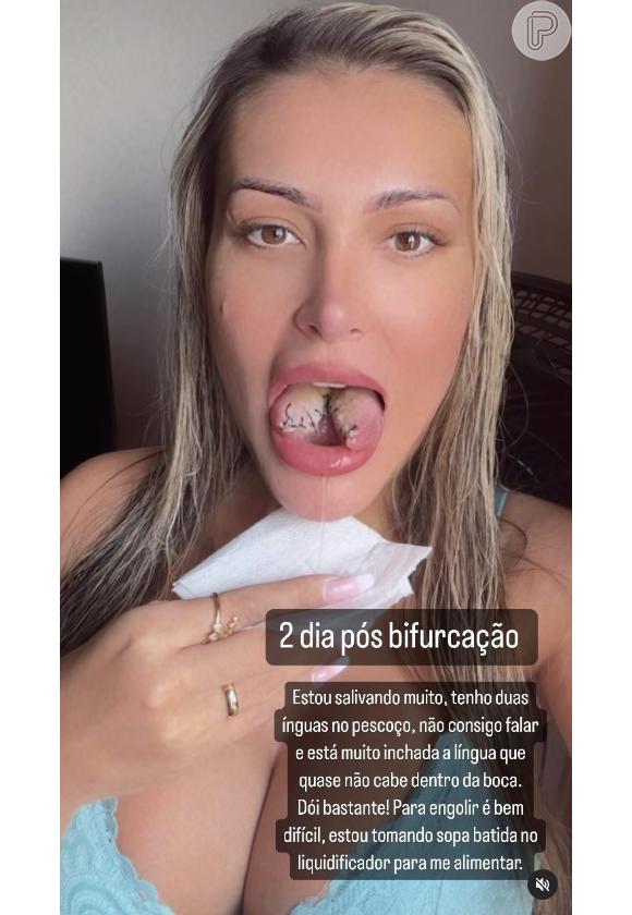 Andressa Urach foi detonada por seguidores, que não gostaram nada do resultado e das imagens mostradas