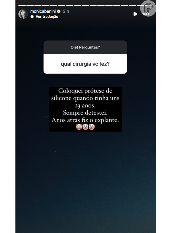 "Coloquei prótese de silicone quando tinha uns 23 anos. Sempre detestei. Anos atrás fiz o explante", disse Mônica Benini nos stories