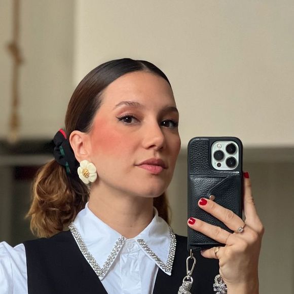 Lorena Comparato disse ter realizado uma cirurgia no nariz quando tinha 24 anos, mas optou por retocá-la recentemente