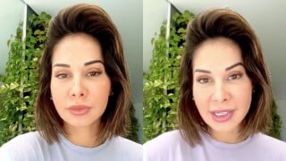 O que é PMMA? Maíra Cardi sofre complicações de aplicação no rosto e revela cirurgia de reconstrução; médico explica riscos
