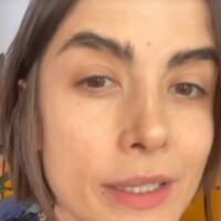 Maria Casadevall, diagnosticada com Síndrome de Eagle, passa por cirurgia e explica condição rara: 'Causador de desconfortos'